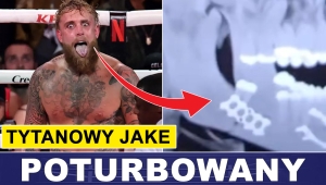 PRASÓWKA: PAUL PO OPERACJI, JOSHUA ZAROBIONY